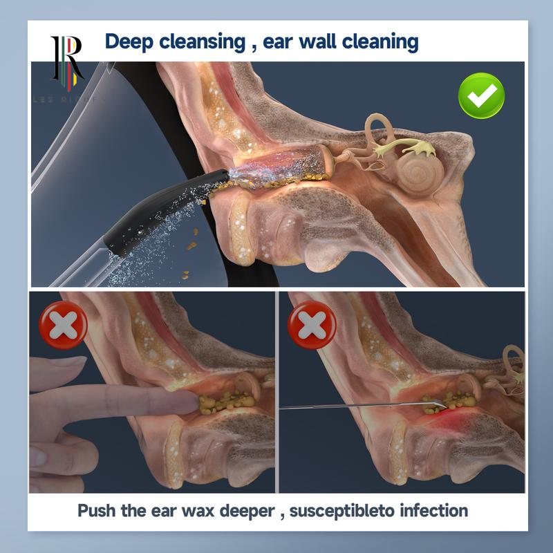 Electric Ear Wax Removal Tool Safe for Effective Removal of Ear Wax Build up